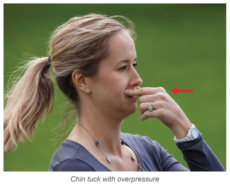 chin tuck swallowing method